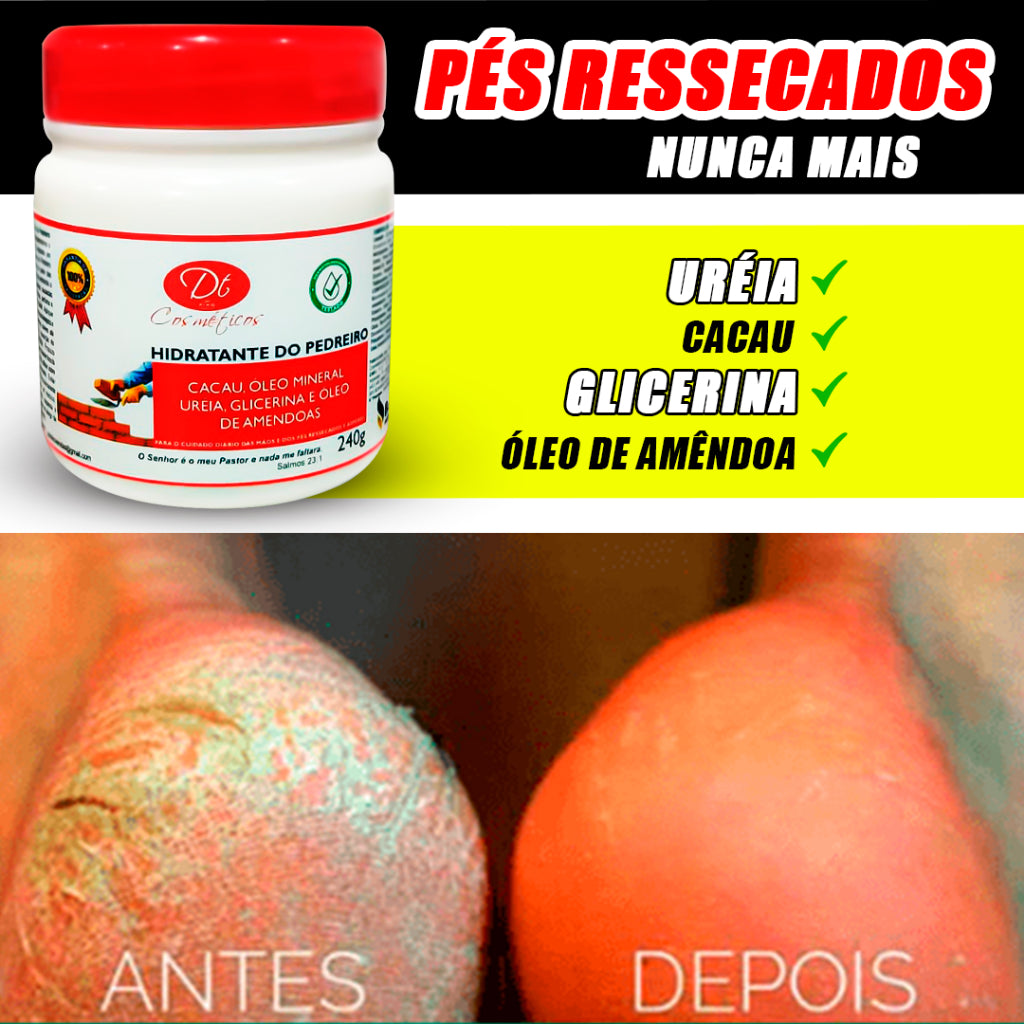 Creme Hidratante De Uréia - Para Pés Rachados E Ressecados - Kaype Store