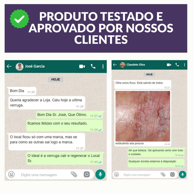 Verrutox - Removedor de Verrugas, Marcas e Manchas | Solução Eficaz e Sem Dor