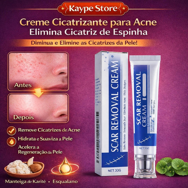 Creme Cicatrizante para Acne - Elimina Cicatriz de Espinha | Kaype Store