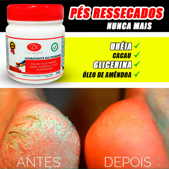 Creme Hidratante De Uréia - Para Pés Rachados E Ressecados - Kaype Store