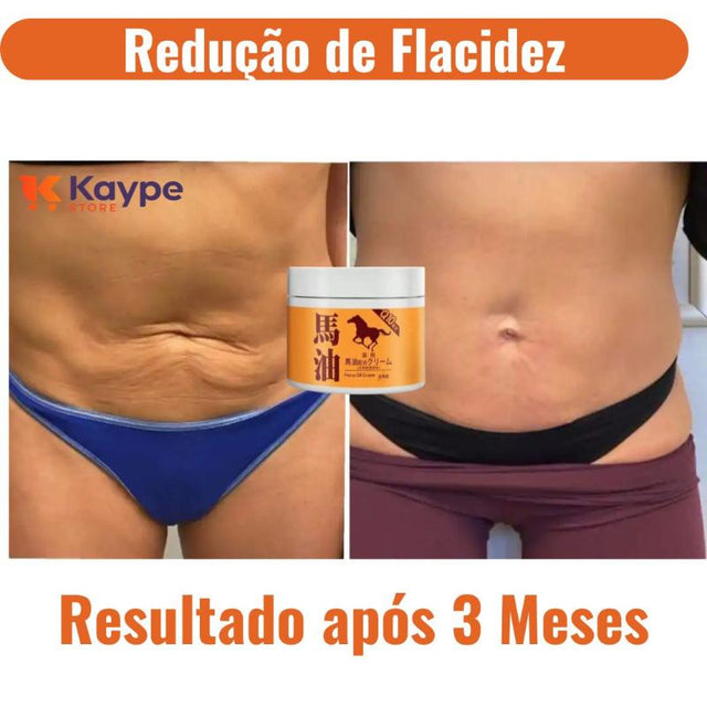 Creme Redutor de Flacidez - Kaype Store
