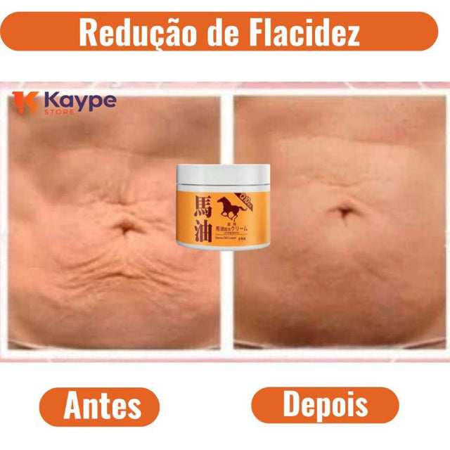 Creme Redutor de Flacidez - Kaype Store