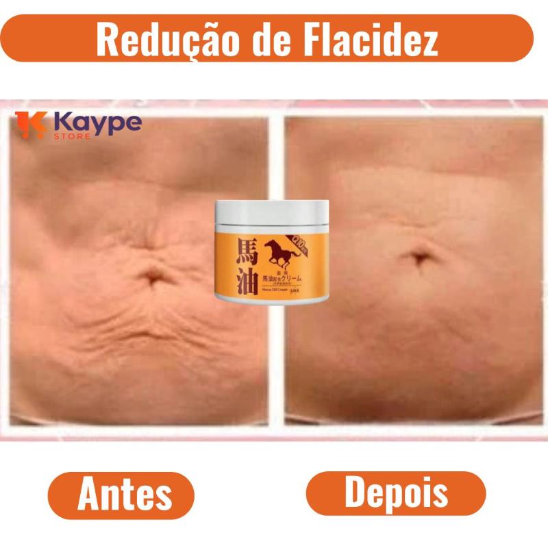 Creme Redutor de Flacidez - Kaype Store