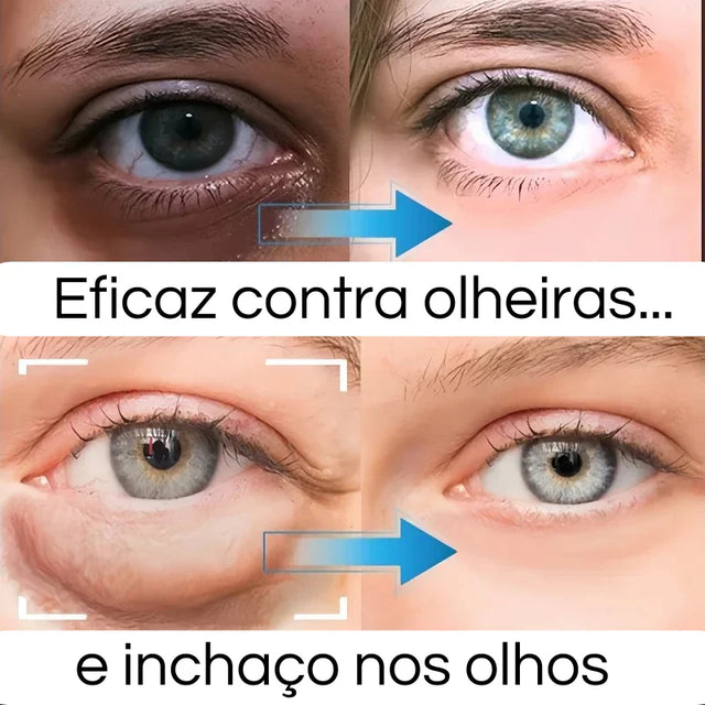 Creme para Olhos Profissional - LumiEyes Collagen 3 em 1 | Kaype Store