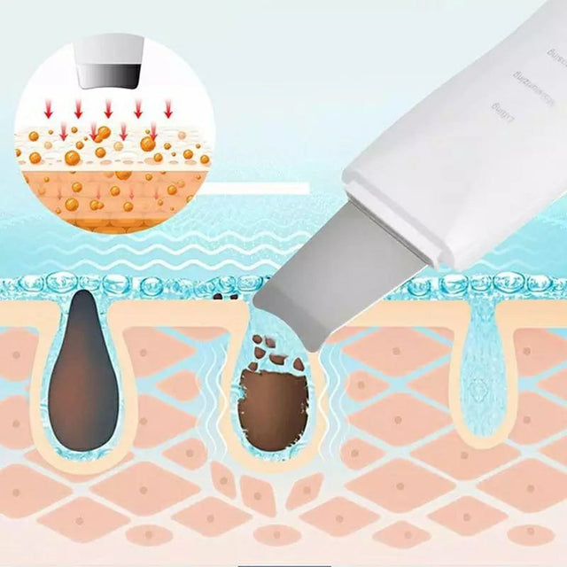 Peeling Ultrassônico Limpador Facial Anti-rugas Sonic Skin Ionização - Kaype Store