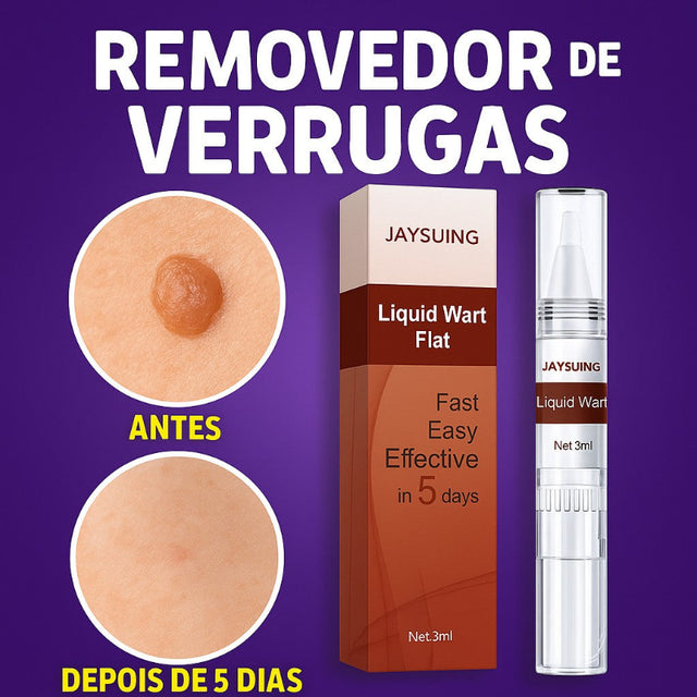 Removedor de Verrugas Genitais HPV – Tratamento Natural Masculino e Feminino - Kaype STore