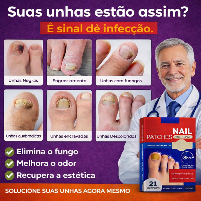 FungoFinal – Adesivo para Unhas | Kaype Store
