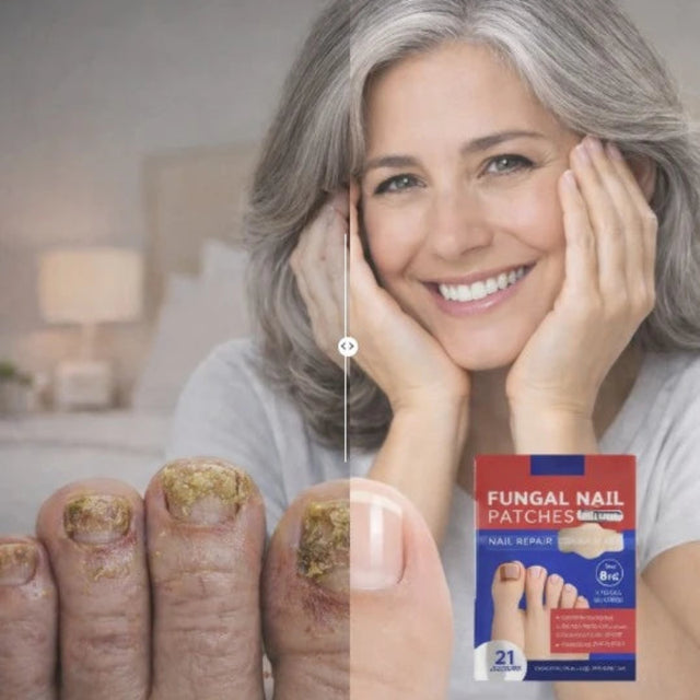 FungoFinal – Adesivo para Unhas | Kaype Store