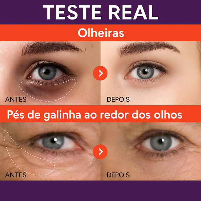 Avocado Cream – Creme Instantâneo Antirrugas e Anti-Olheiras | Kaype Store