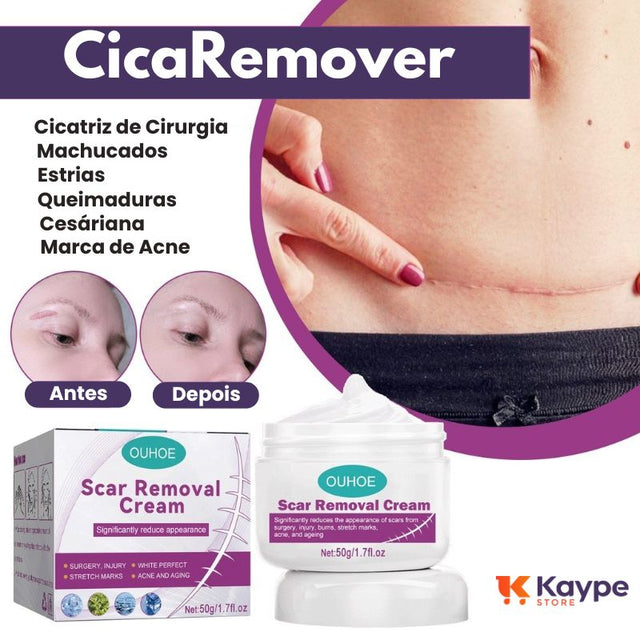 CicaRemover - Removedor de Cicatrizes Profissional - Kaype Store