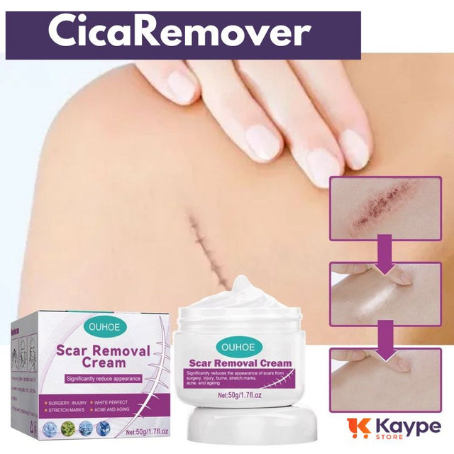 CicaRemover - Removedor de Cicatrizes Profissional - Kaype Store