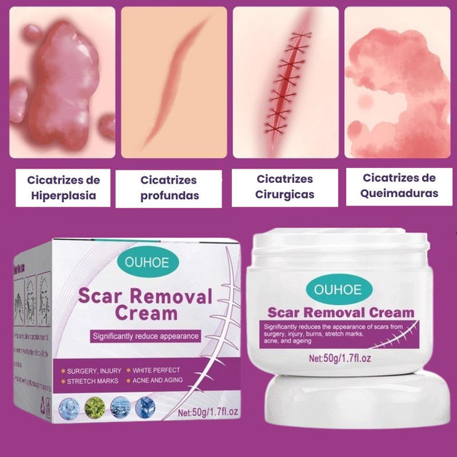 CicaRemover - Removedor de Cicatrizes Profissional - Kaype Store