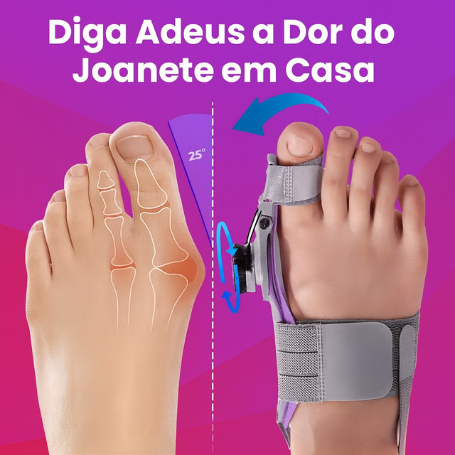 Corretor de Joanete Profissional - Joanete Pro | Kaype Store