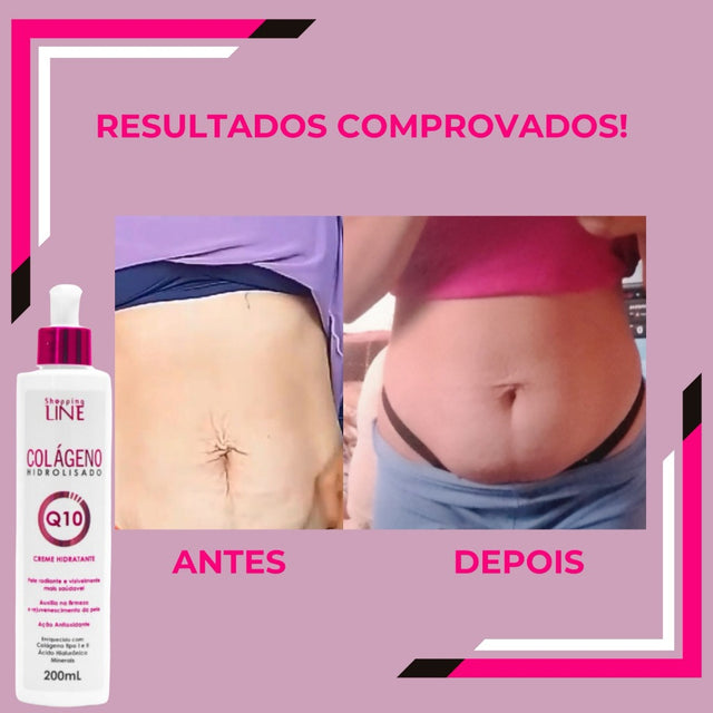 Creme Colágeno Q10 Rejuvenescedor: Firmeza, Hidratação e Anti-idade