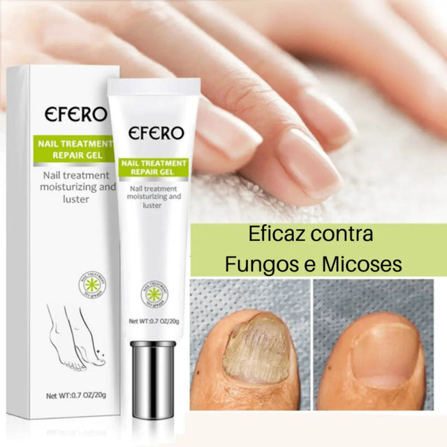 Efero Nail Repair – Gel para Fungos e Micose nas Unhas | Kaype Store