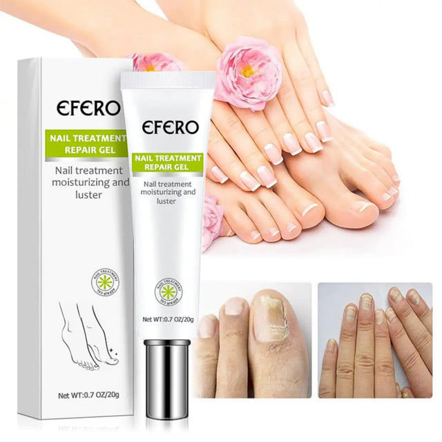 Efero Nail Repair – Gel para Fungos e Micose nas Unhas | Kaype Store