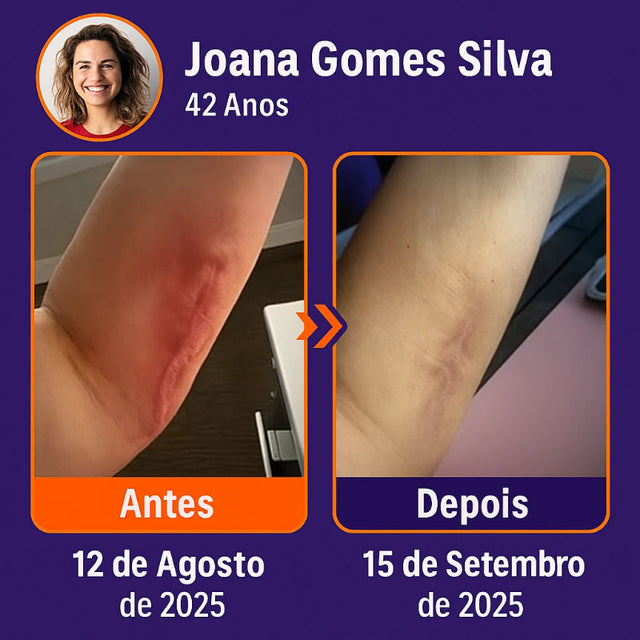 Fita Reparadora de Microagulhas com Ácido Hialurônico – Remove Cicatrizes, Estrias e Manchas