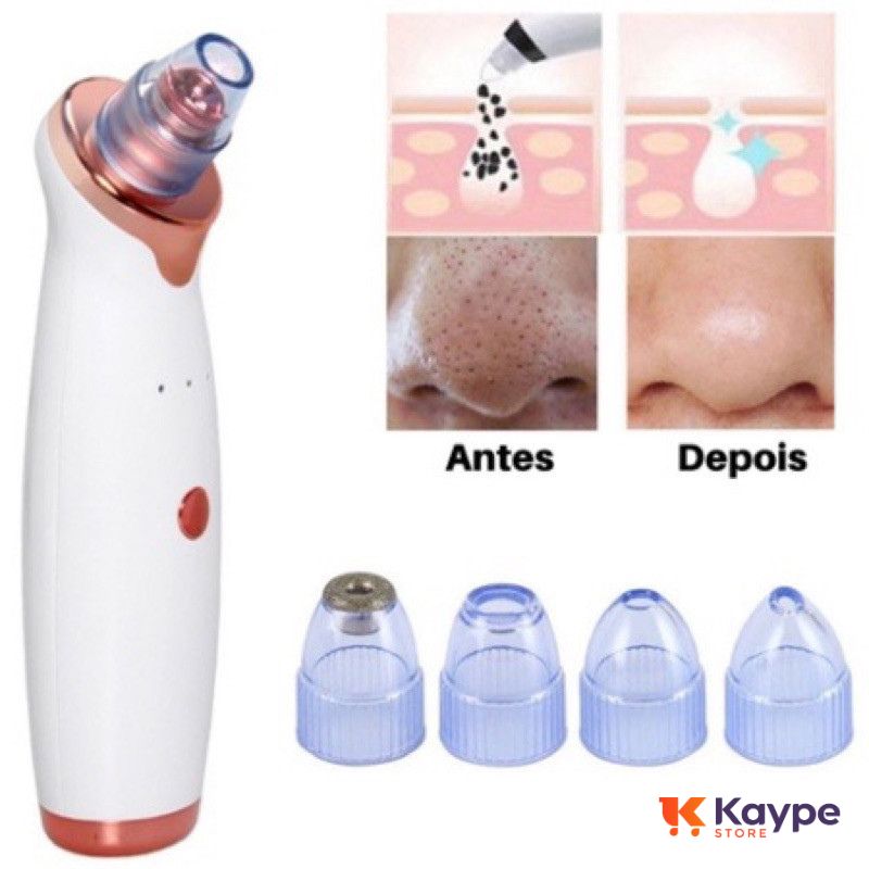 Removedor de Poros Elétrico 3 em 1 - Peeling Diamante - Kaype Store