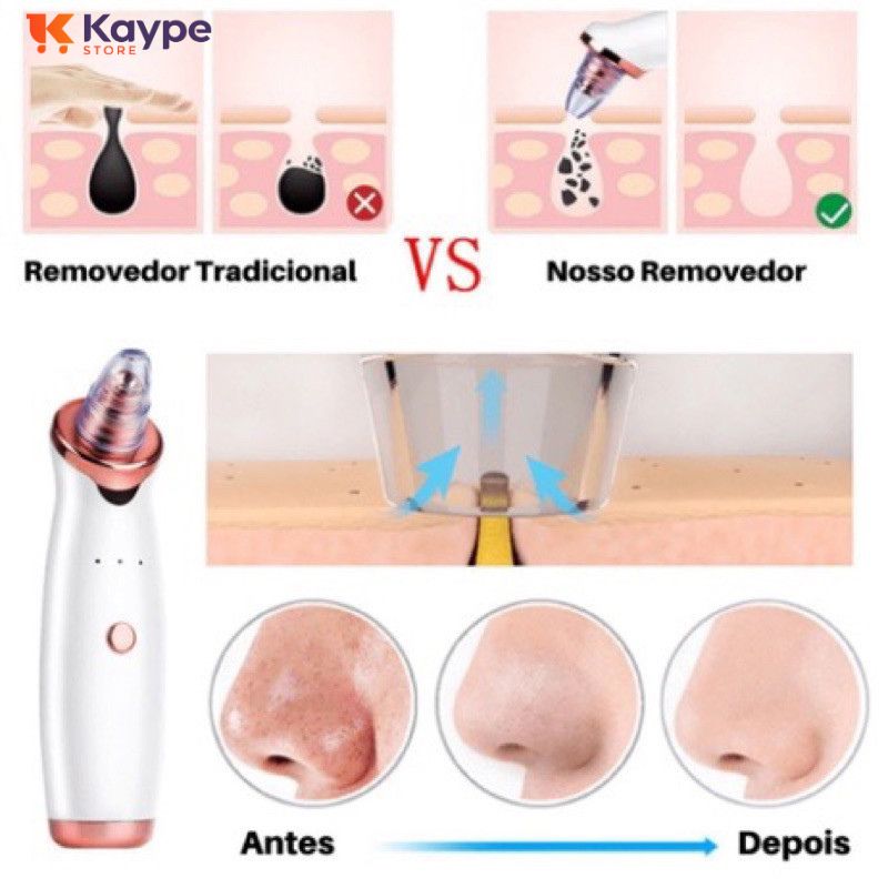 Removedor de Poros Elétrico 3 em 1 - Peeling Diamante - Kaype Store