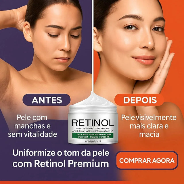 Retinol Premium Original - Creme Clareador para Virilha, Cotovelos e Axilas | Eficácia Comprovada – Kaype Store