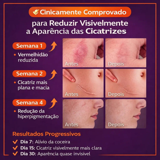 Scar Removal Cream — Creme para Cicatrizes Rosto e Corpo | Recuperação Avançada (30g)