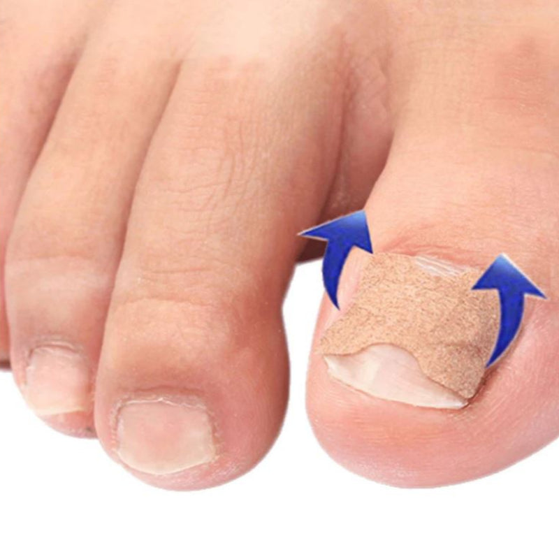 Kit Encravex – Adesivo para Apoio ao Crescimento Natural das Unhas