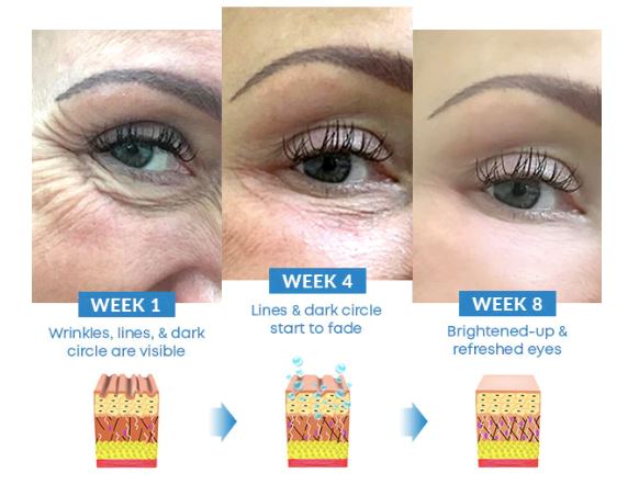 Creme Clareador Anti Olheiras Bolsas Para Os Olhos - Kaype Store