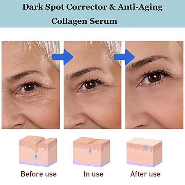 Creme Clareador Anti Olheiras Bolsas Para Os Olhos - Kaype Store