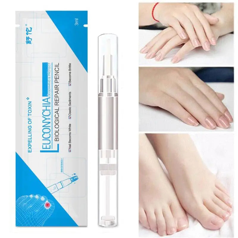 Fungo Pen Profissional - Elimine os Fungos e Micose das Unhas Rapidamente Kaypestore