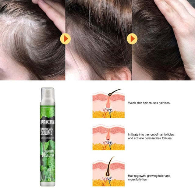 Spray para Crescimento Capilar KaypeStore - Solução para Queda de Cabelo