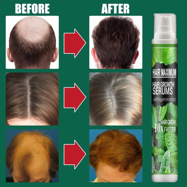 Spray para Crescimento Capilar KaypeStore - Solução para Queda de Cabelo