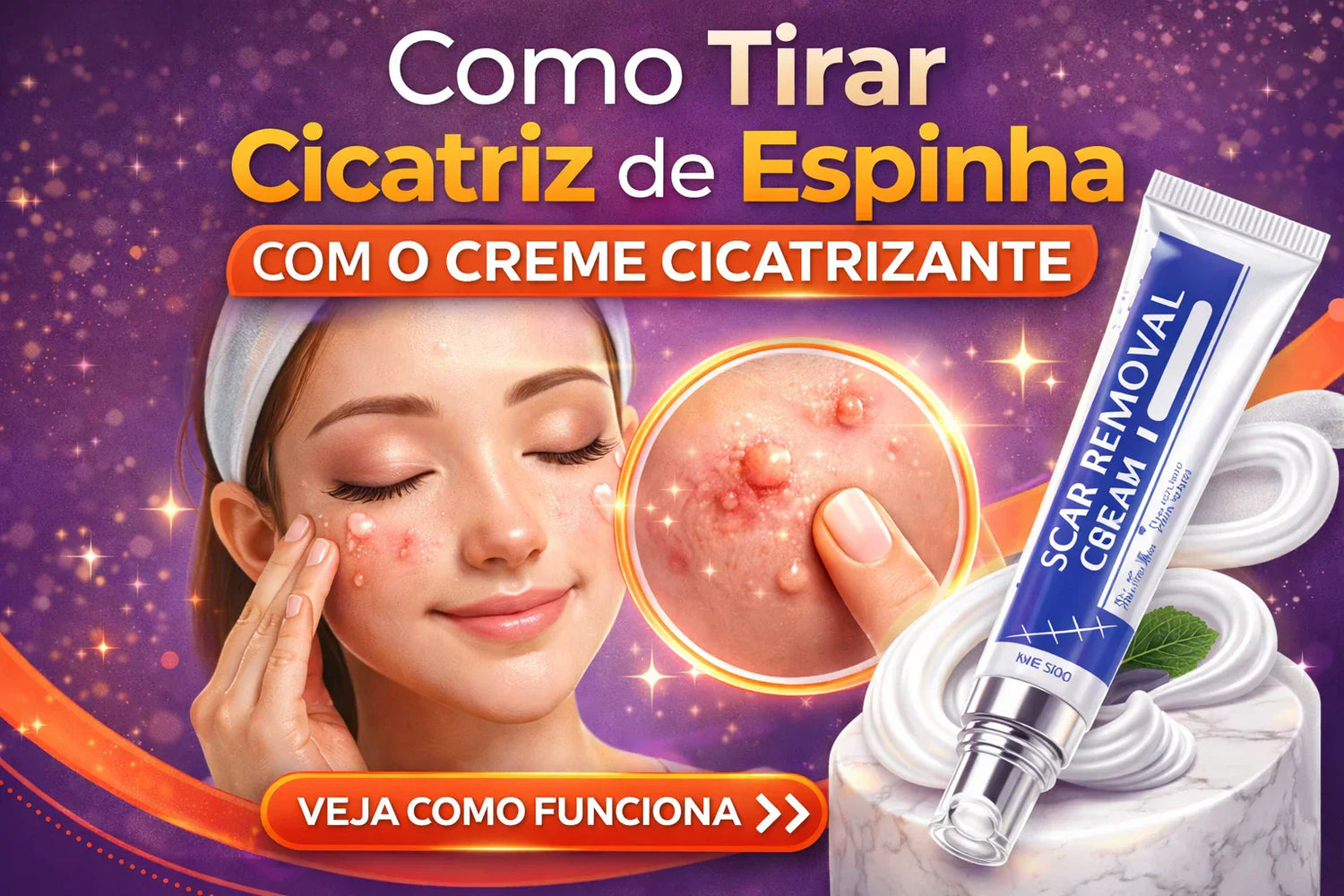 Como Tirar Cicatriz de Espinha com o Creme Cicatrizante para Acne: O Tratamento Eficaz para sua Pele