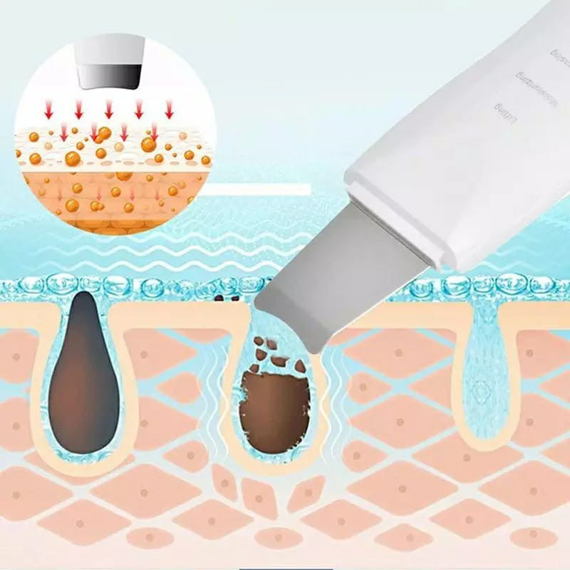 Peeling Ultrassônico Limpador Facial Anti-rugas Sonic Skin Ionização - Kaype Store