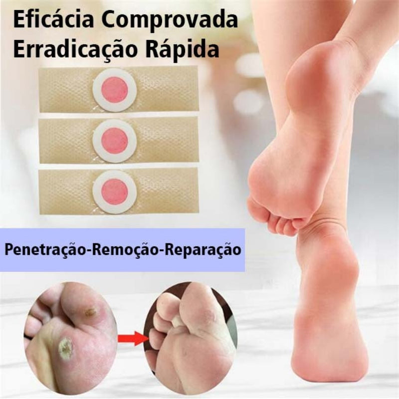 Adesivos Removedor De Calos Verrugas Olho De Peixe Original - Kaype Store