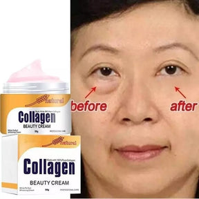 Creme de Colágeno: A Solução Definitiva para Rugas e Bolsas nos Olhos - Kaype Store