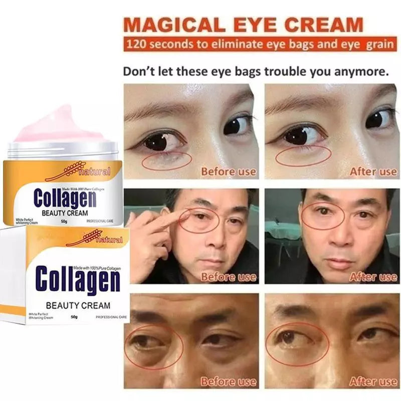 Creme de Colágeno: A Solução Definitiva para Rugas e Bolsas nos Olhos - Kaype Store