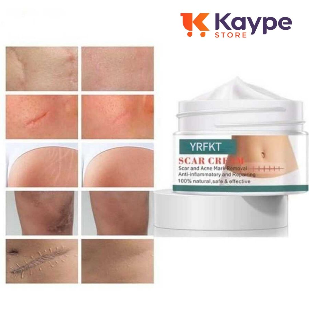 Cica Cream Creme Para Marcas e Cicatriz - Kaype Store