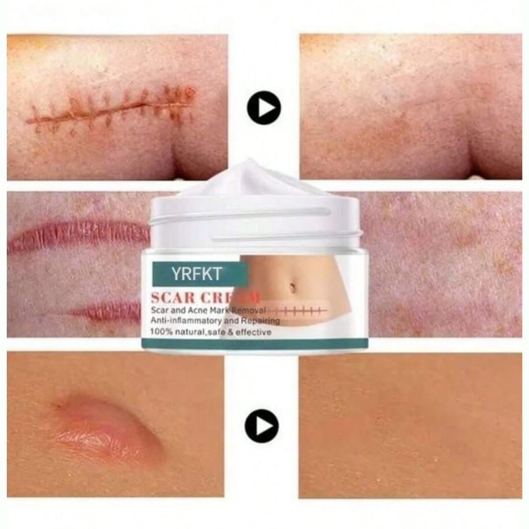 Cica Cream Creme Para Marcas e Cicatriz - Kaype Store