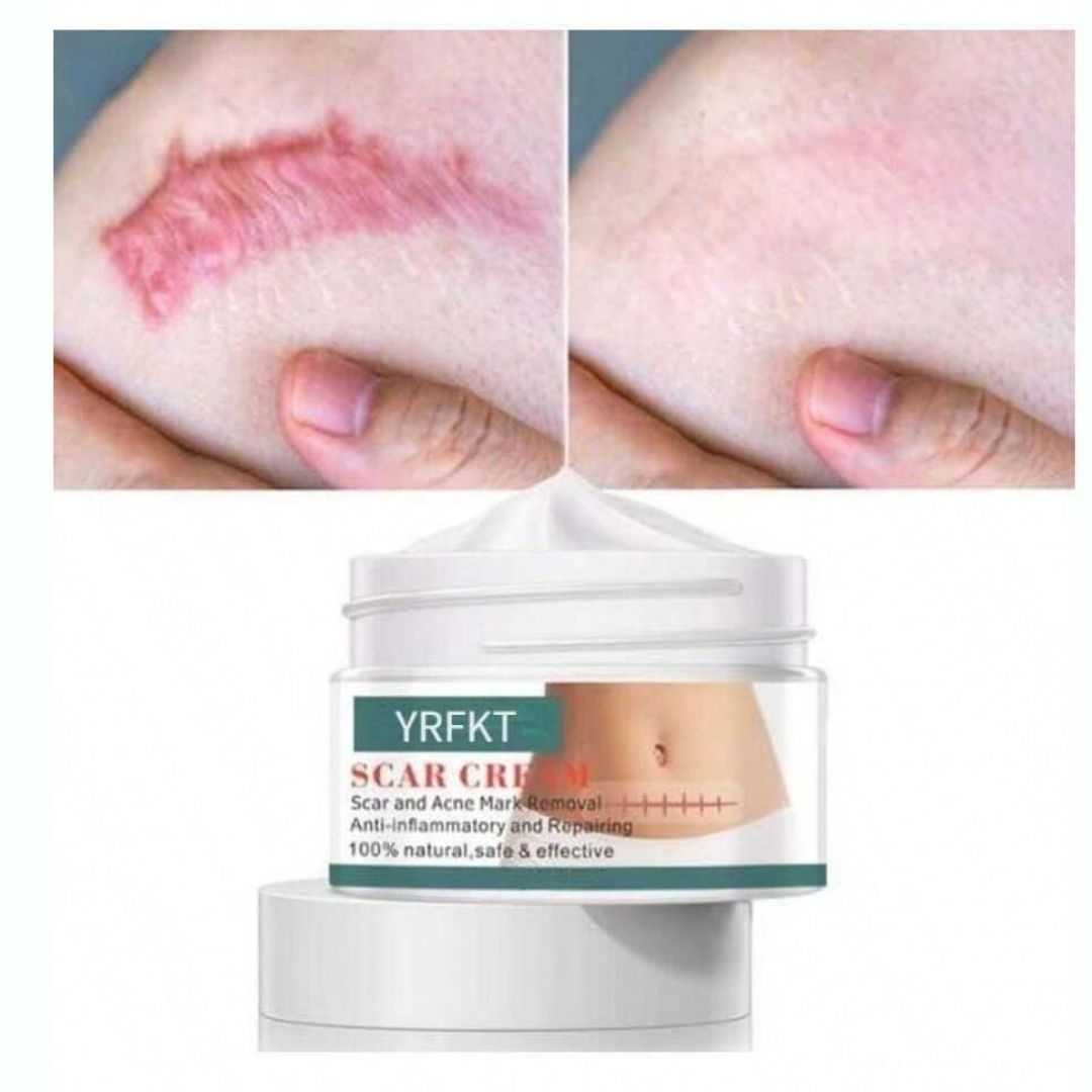 Cica Cream Creme Para Marcas e Cicatriz - Kaype Store