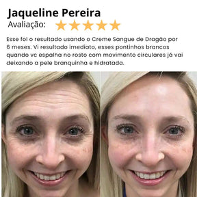 Creme Kaype Lifting, Rejuvenece e Firma - Sangue de Dragão Puro - Kaype Store