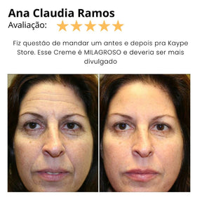 Creme Kaype Lifting, Rejuvenece e Firma - Sangue de Dragão Puro - Kaype Store