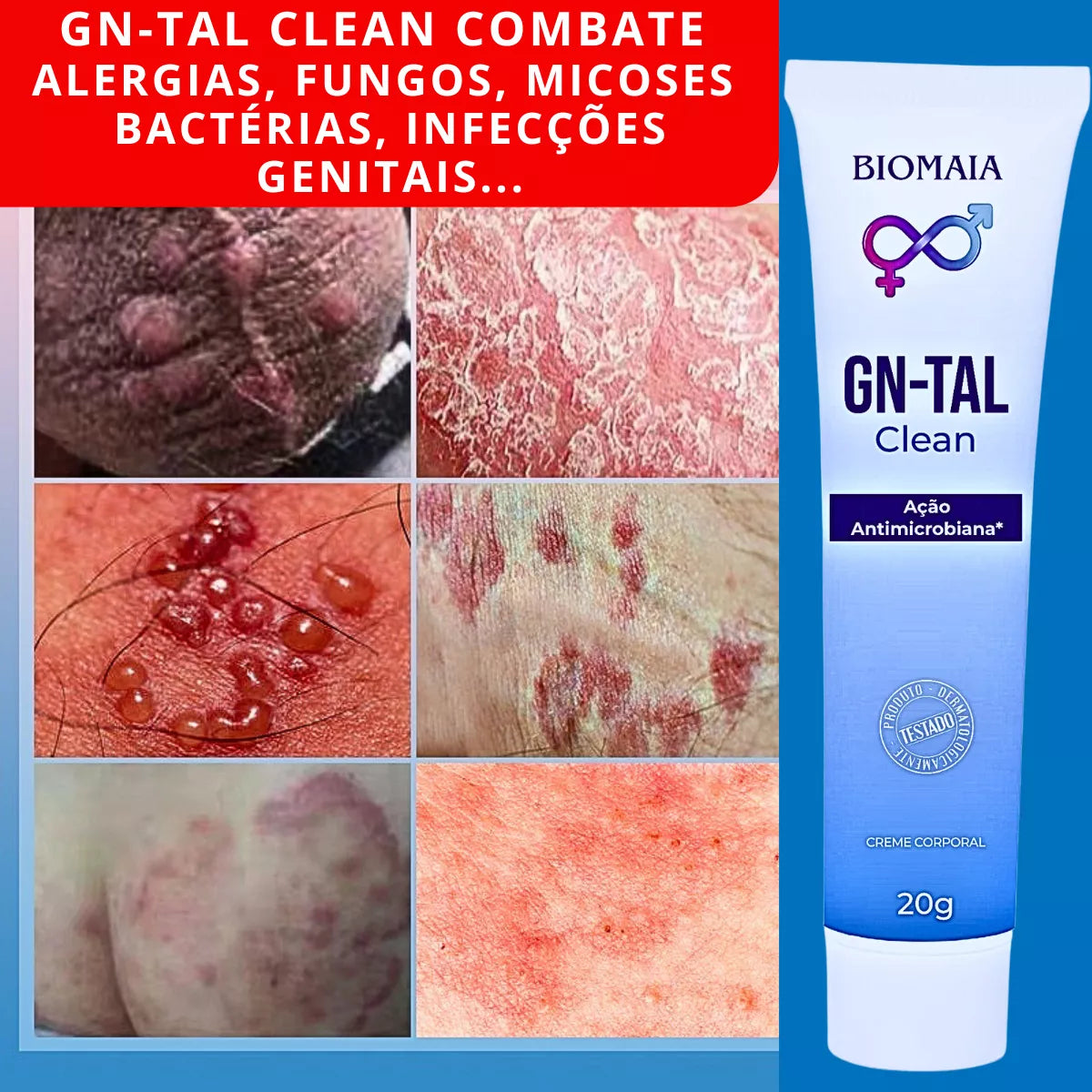 Pomada Antifúngica Íntima Masculina e Feminina - Solução Eficaz para Micoses Genitais