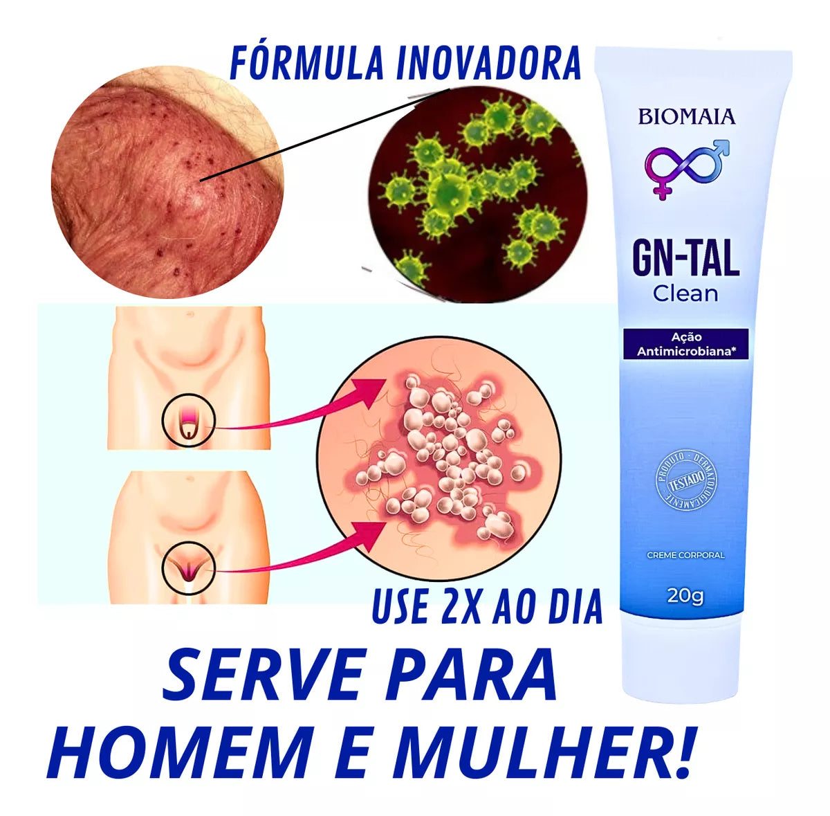 Pomada Antifúngica Íntima Masculina e Feminina - Solução Eficaz para Micoses Genitais
