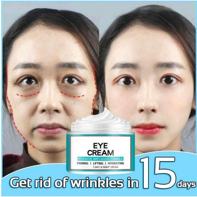 Eye Cream - Acabe com Olheiras, Bolsas e Rugas ao Redor dos Olhos - Kaype Store
