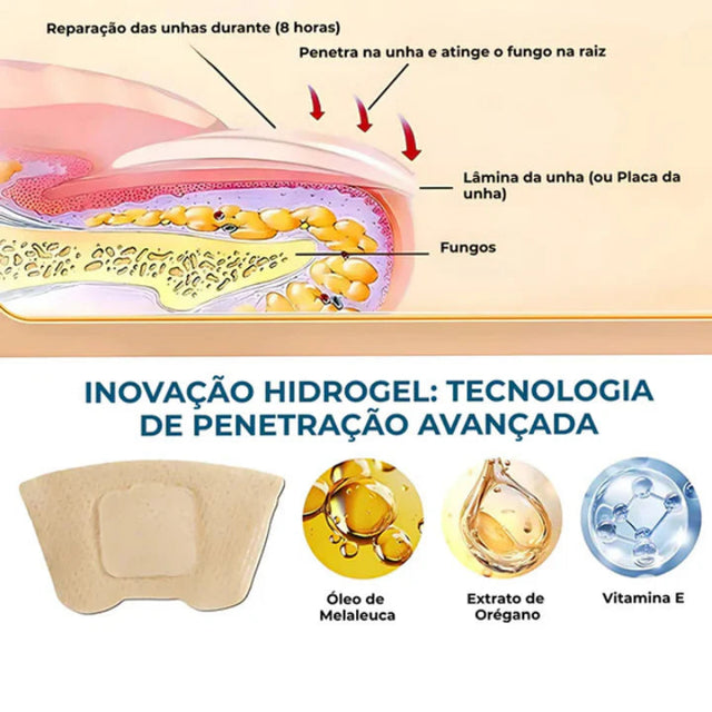 FungoFinal – Adesivo  para Unhas | Kaype Store