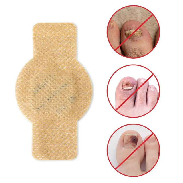 FungoFinal – Adesivo  para Unhas | Kaype Store