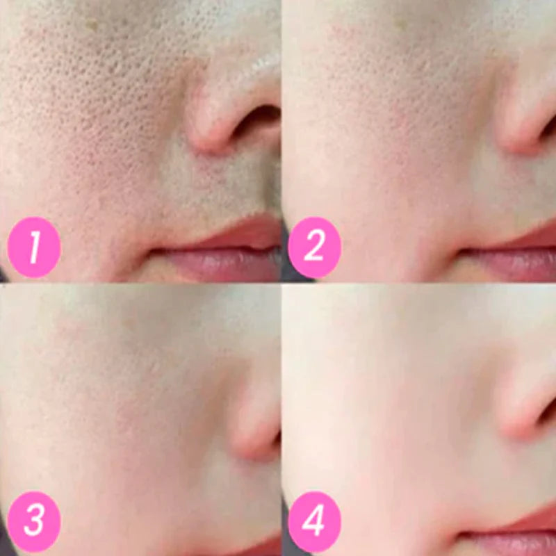 Creme Mágico FaceSlift: Transforme sua Pele! - Kaype Store