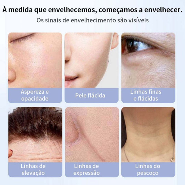 RugasRenew – Tecnologia Japonesa 28 Dias | Creme Anti-Rugas Rejuvenescedor & Firmador