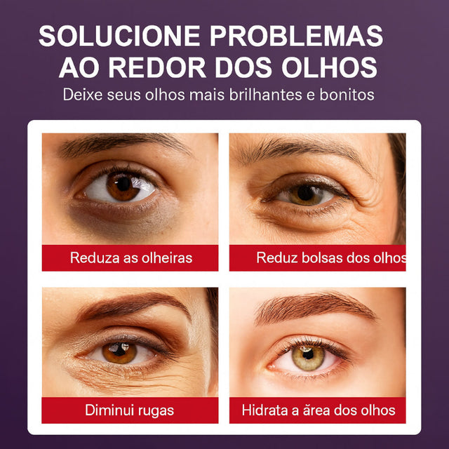 Creme em Bastão Para Os Olhos Com Retinol - Remove Bolsas, Melhora as Olheiras e Hidrata a Área dos Olhos | Kaype Store