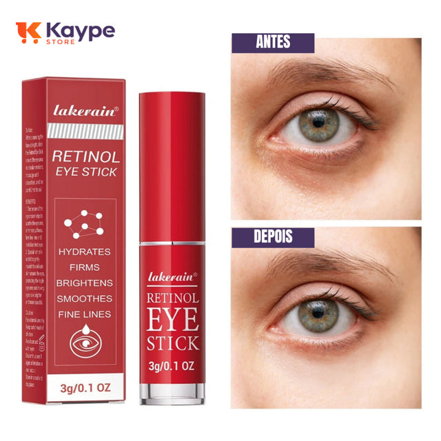 Creme em Bastão Para Os Olhos Com Retinol - Remove Bolsas, Melhora as Olheiras e Hidrata a Área dos Olhos | Kaype Store